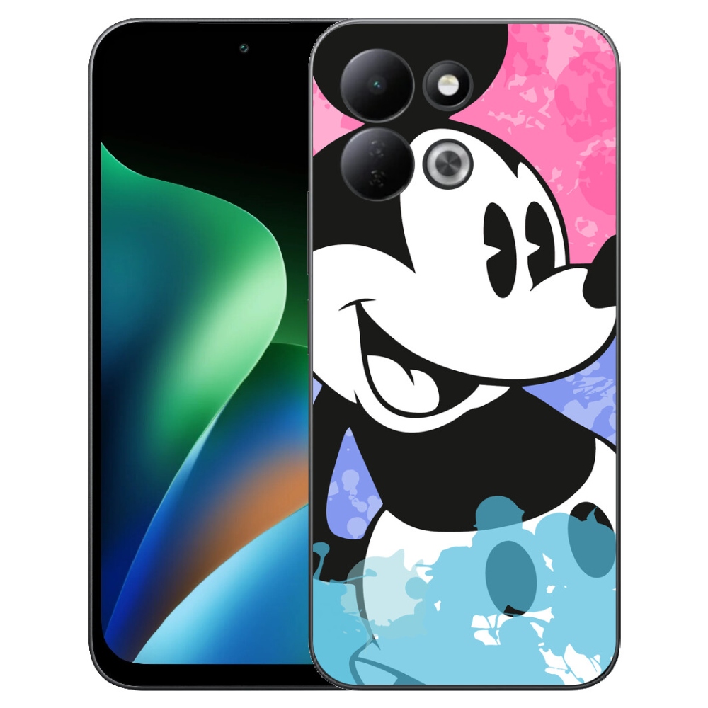 mmCase géltok a Xiaomi Redmi 17 4G/5G-hez – Mickey Mouse
