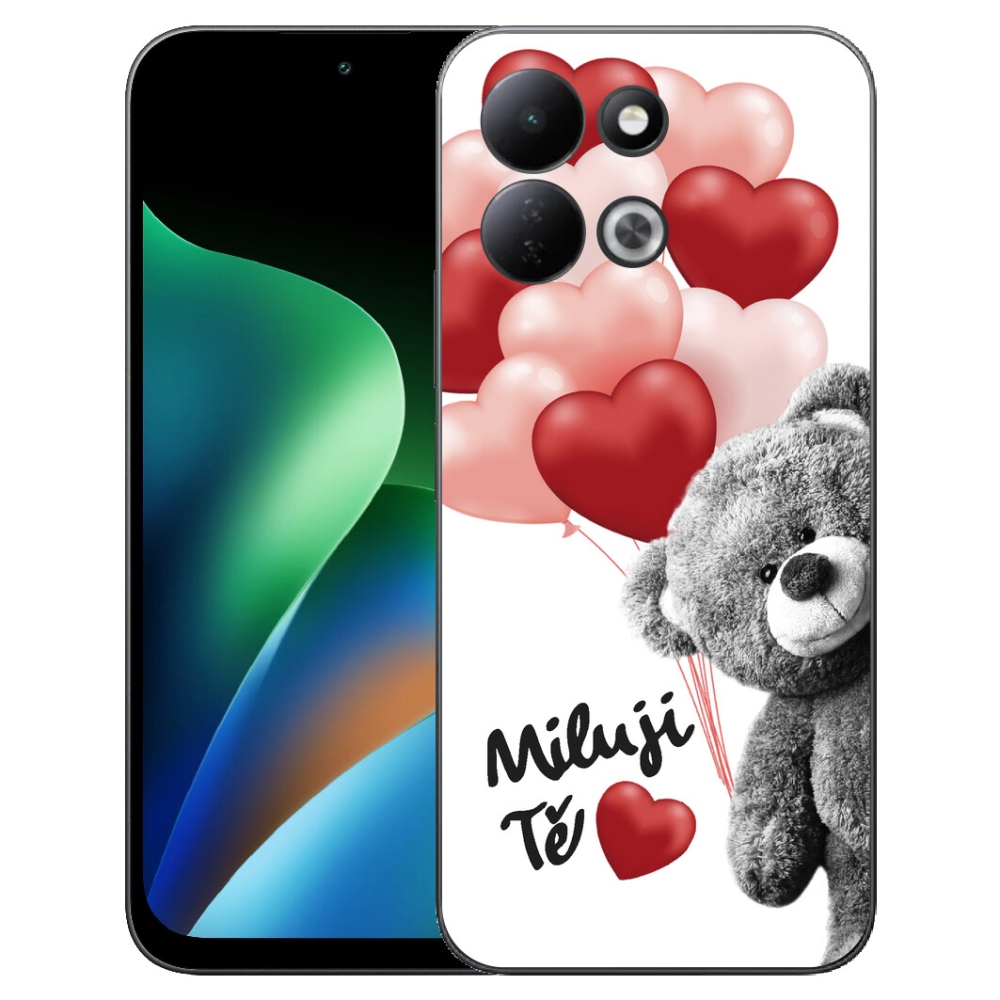 mmCase gél tok a Xiaomi Redmi 17 4G/5G-hez – imádlak