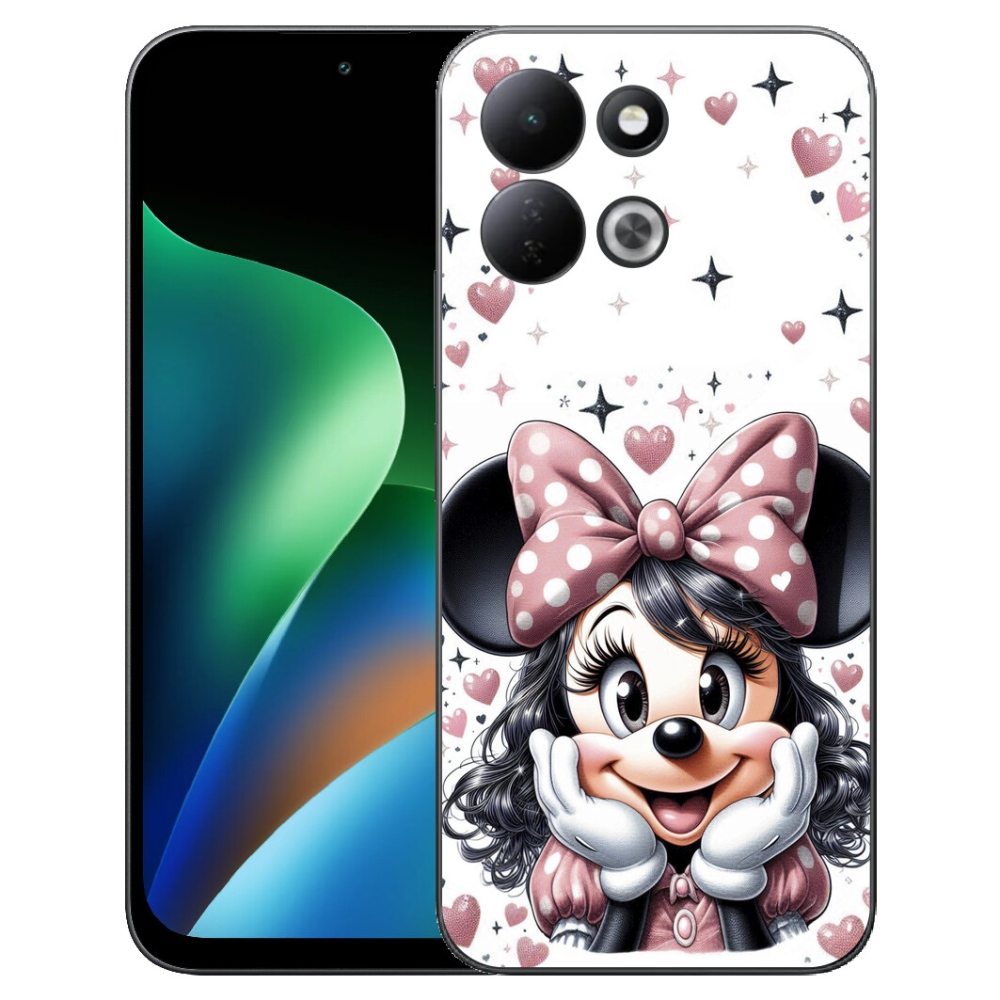 mmCase gélhuzat a Xiaomi Redmi 17 4G/5G-hez – minnie