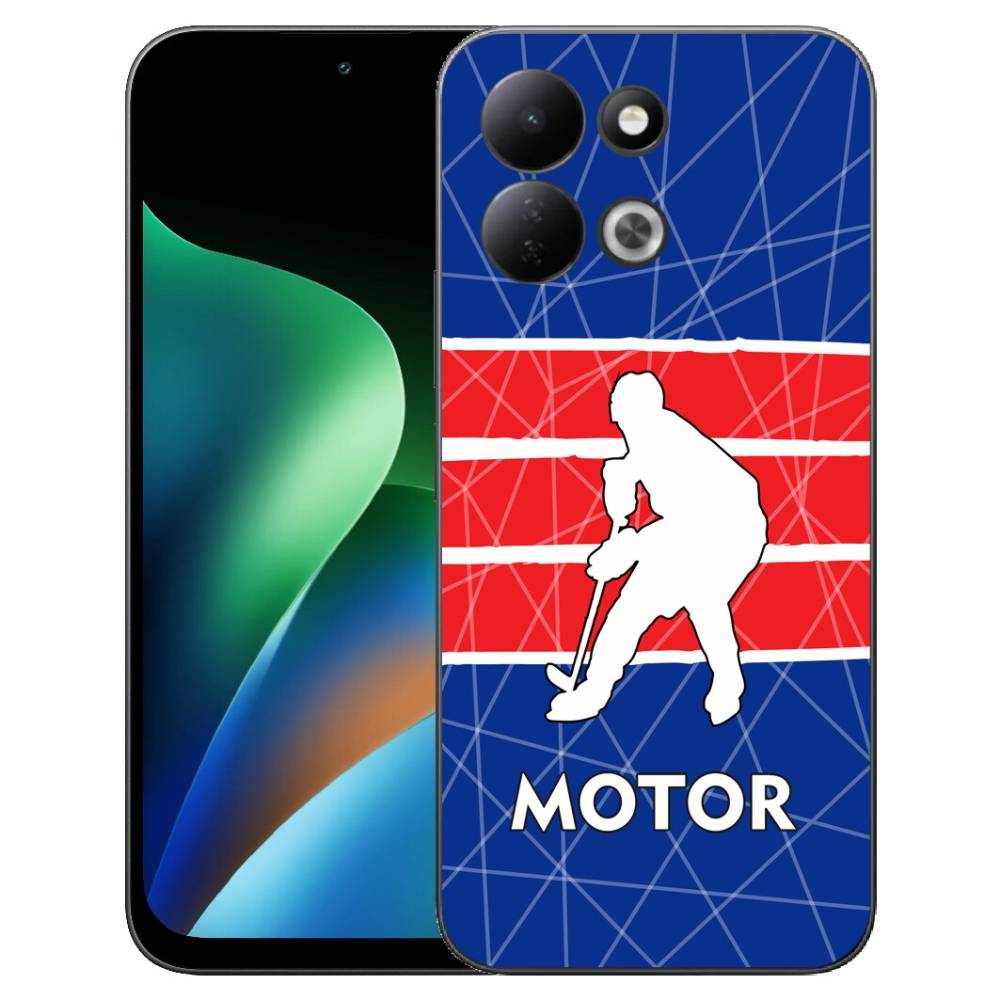 mmCase gélhuzat a Xiaomi Redmi 17 4G/5G-hez – Motor