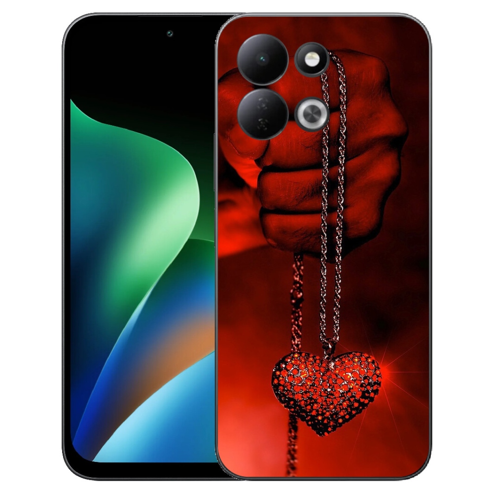 mmCase gél tok a Xiaomi Redmi 17 4G/5G-hez – nyaklánc