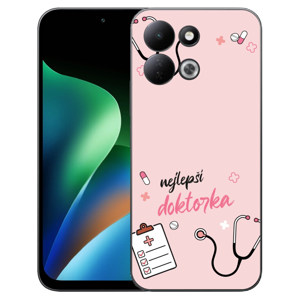 mmCase géltok a Xiaomi Redmi 17 4G/5G-hez – a legjobb doki