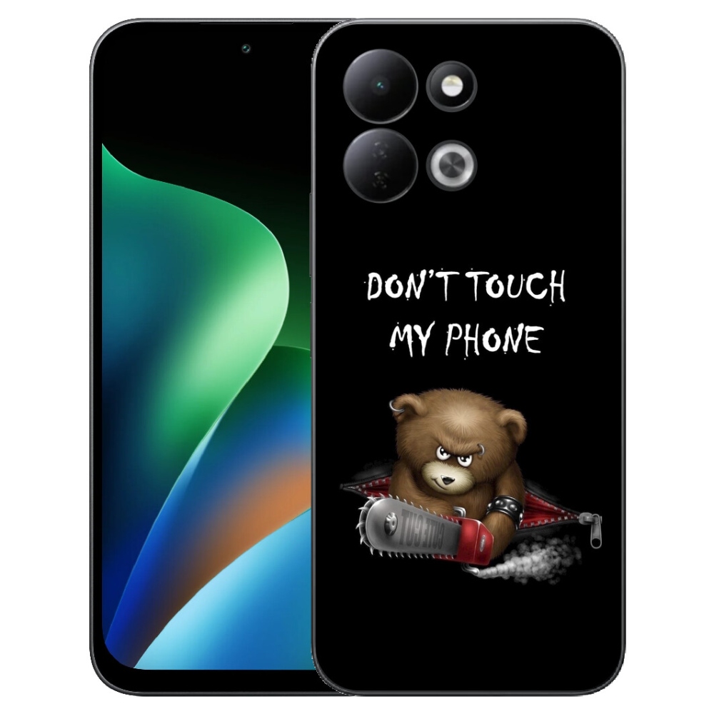 mmCase géltok a Xiaomi Redmi 17 4G/5G-hez – ne érintsd meg a telefont