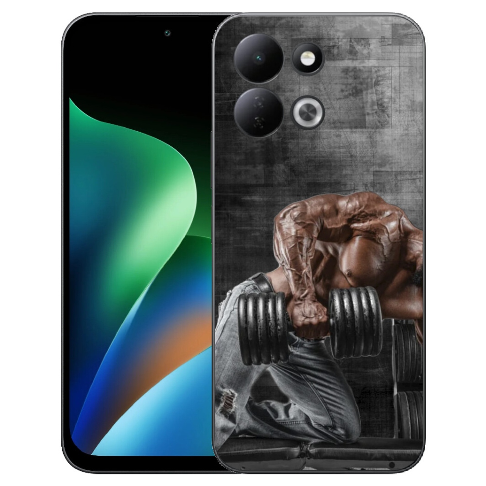 mmCase géltok a Xiaomi Redmi 17 4G/5G-hez – megerősítés 1