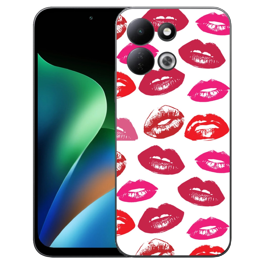 mmCase géltok a Xiaomi Redmi 17 4G/5G készülékhez – ajkak