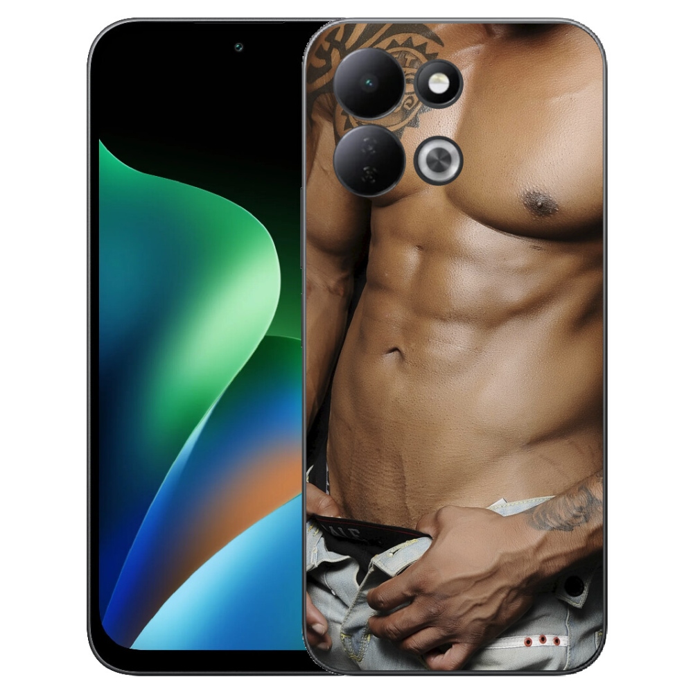 mmCase géltok a Xiaomi Redmi 17 4G/5G-hez – szexi férfi