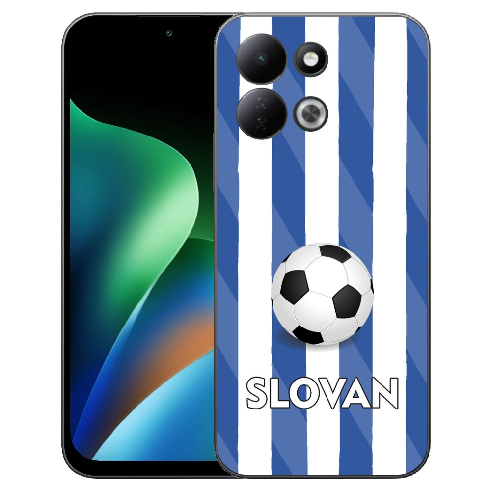mmCase géltok a Xiaomi Redmi 17 4G/5G-hez – Slovan