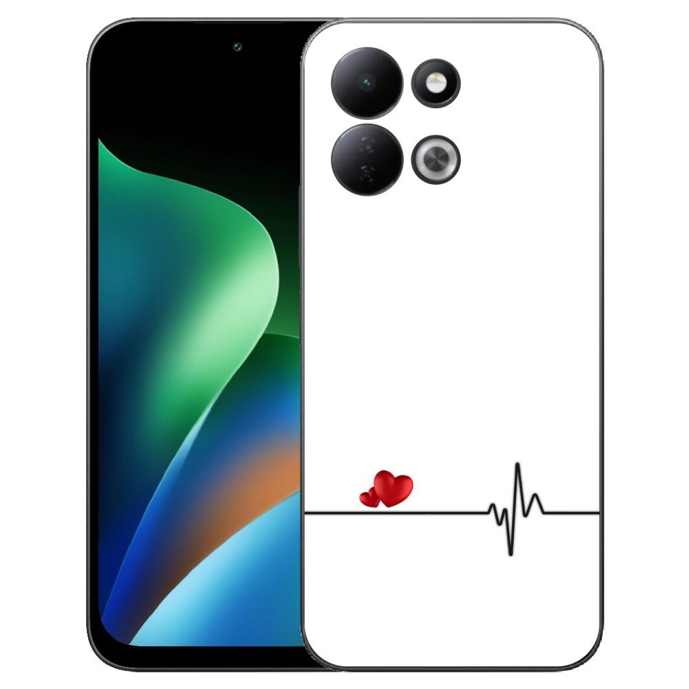 mmCase géltok a Xiaomi Redmi 17 4G/5G-hez – szív és pulzus fehér háttérrel