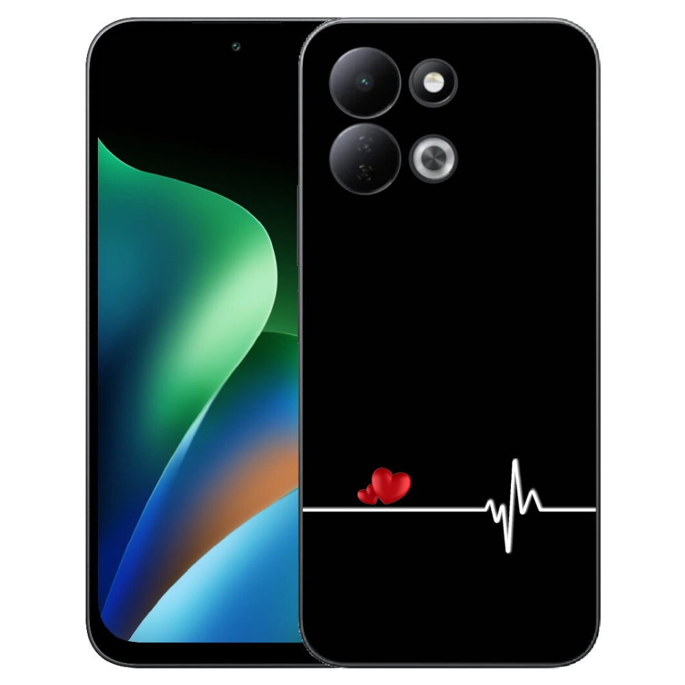 mmCase géltok a Xiaomi Redmi 17 4G/5G-hez – szív és pulzus fekete háttérrel