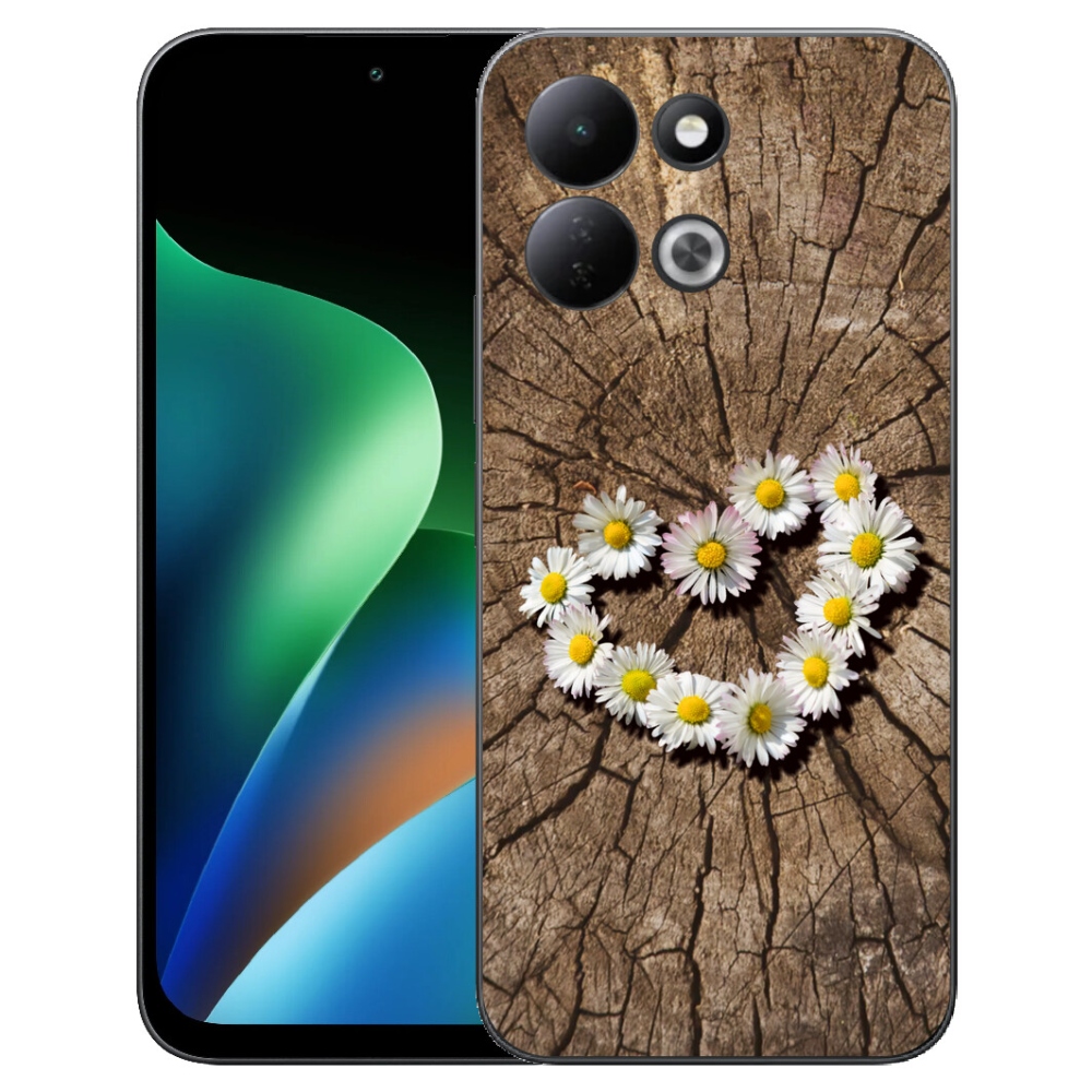 mmCase géltok a Xiaomi Redmi 17 4G/5G-hez – margaréta mintás