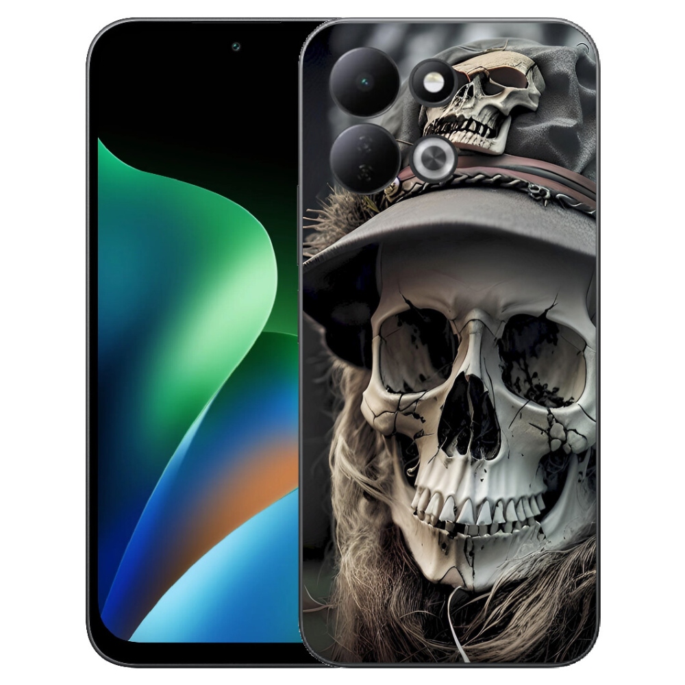 mmCase géltok a Xiaomi Redmi 17 4G/5G-hez – sötét koponya