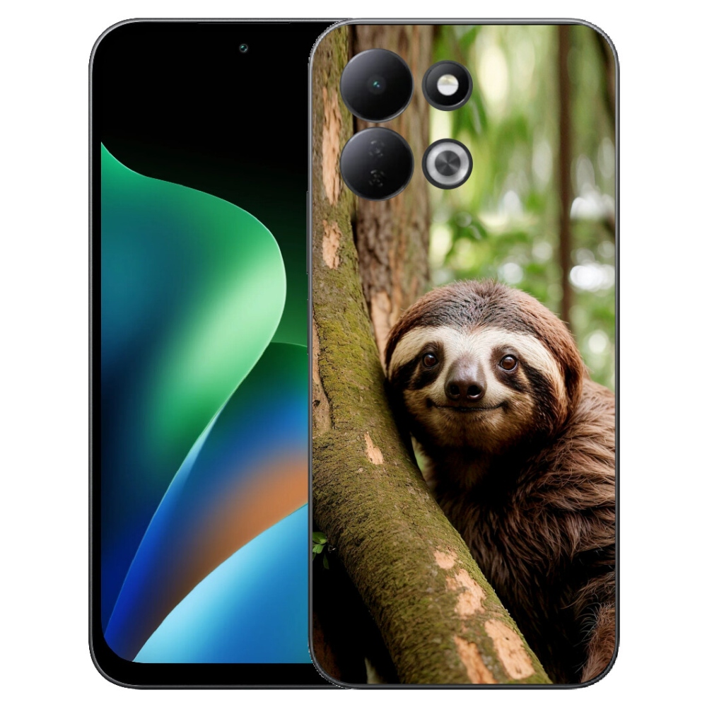 mmCase géltok a Xiaomi Redmi 17 4G/5G-hez – mosolygós lajhár