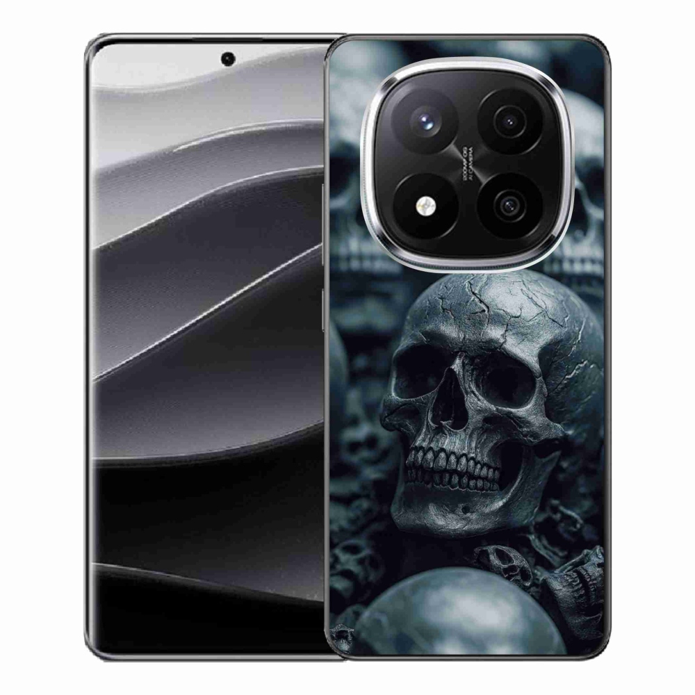 Gél borítás mmCase a Xiaomi Redmi Note 14 Pro+ 5G - koponya 2