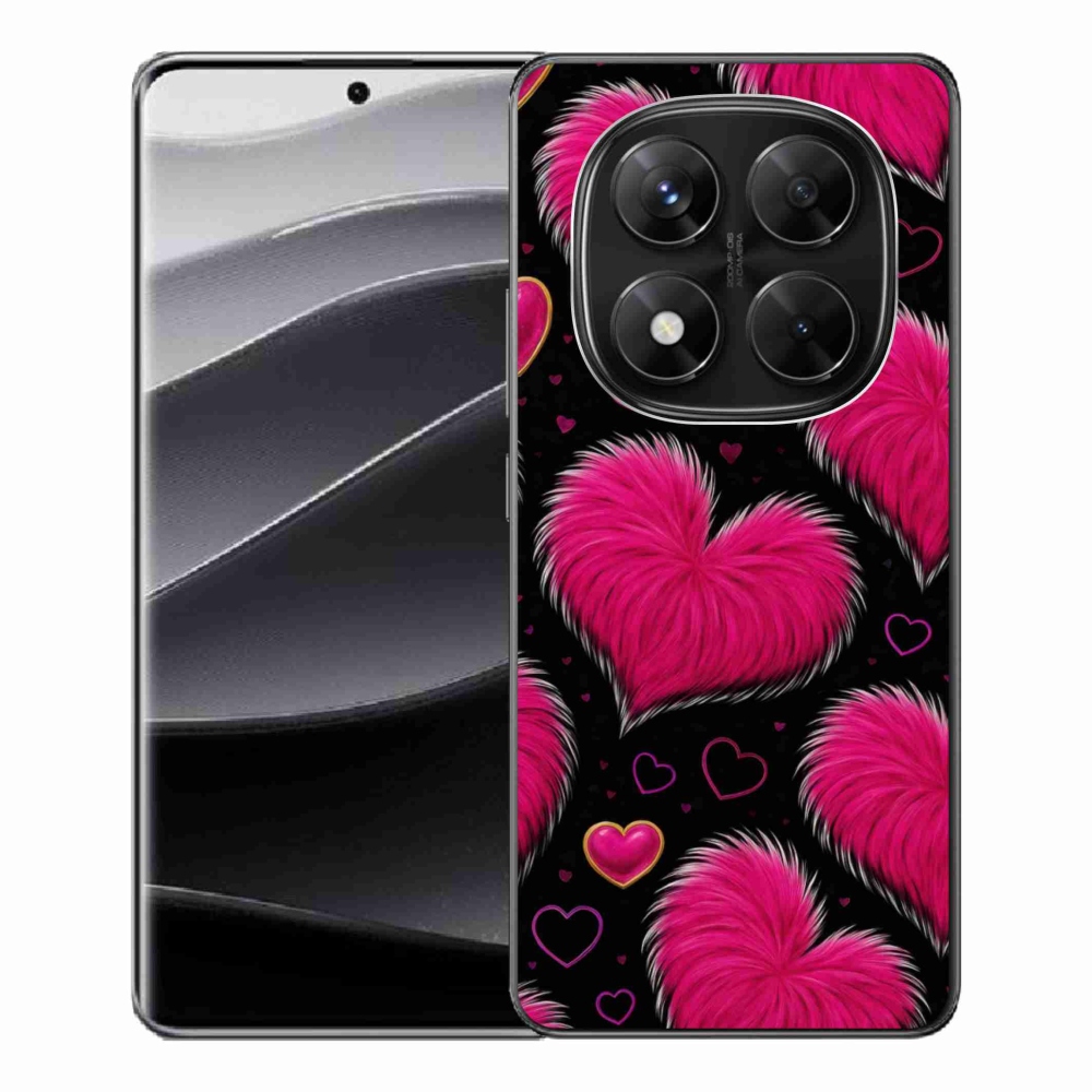 Gél borítás mmCase a Xiaomi Redmi Note 14 Pro 5G/Poco X7 5G számára - puha szív