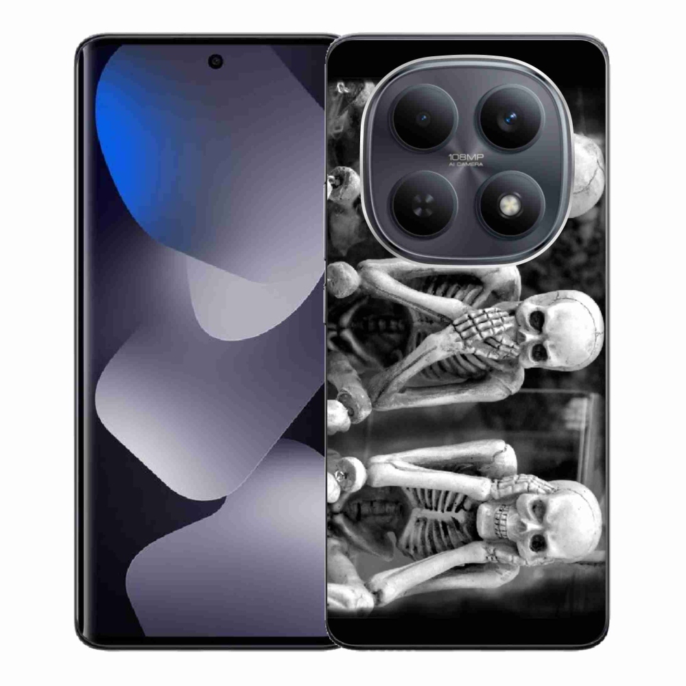 Gél borítás mmCase a Xiaomi Redmi Note 15 4G - csontvázakhoz
