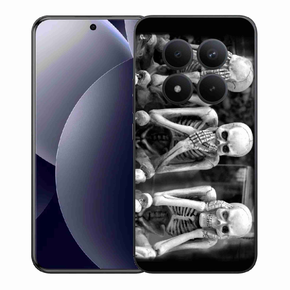 Gél borítás mmCase a Xiaomi Redmi Note 15 Pro+ 5G/Xiaomi Poco M8 Pro 5G - csontvázakhoz