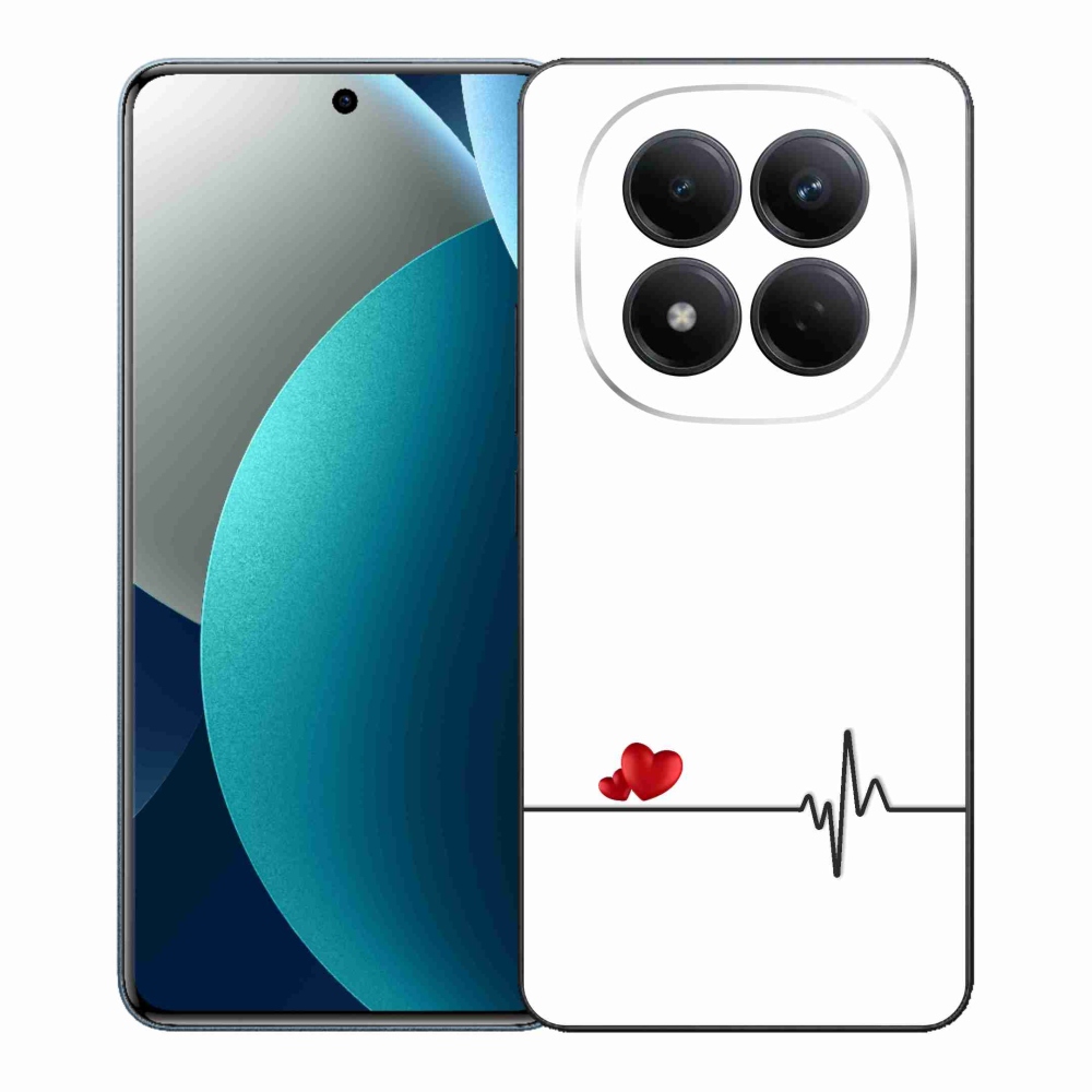 Gél borítás mmCase a Xiaomi Redmi Note 15 Pro számára - szív és szívverés fehér háttérrel