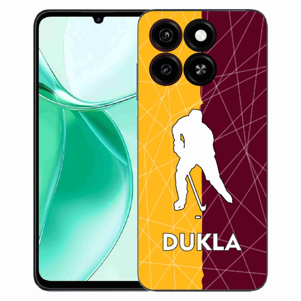 ZTE Blade A35 zselés tok mmCase - Dukla