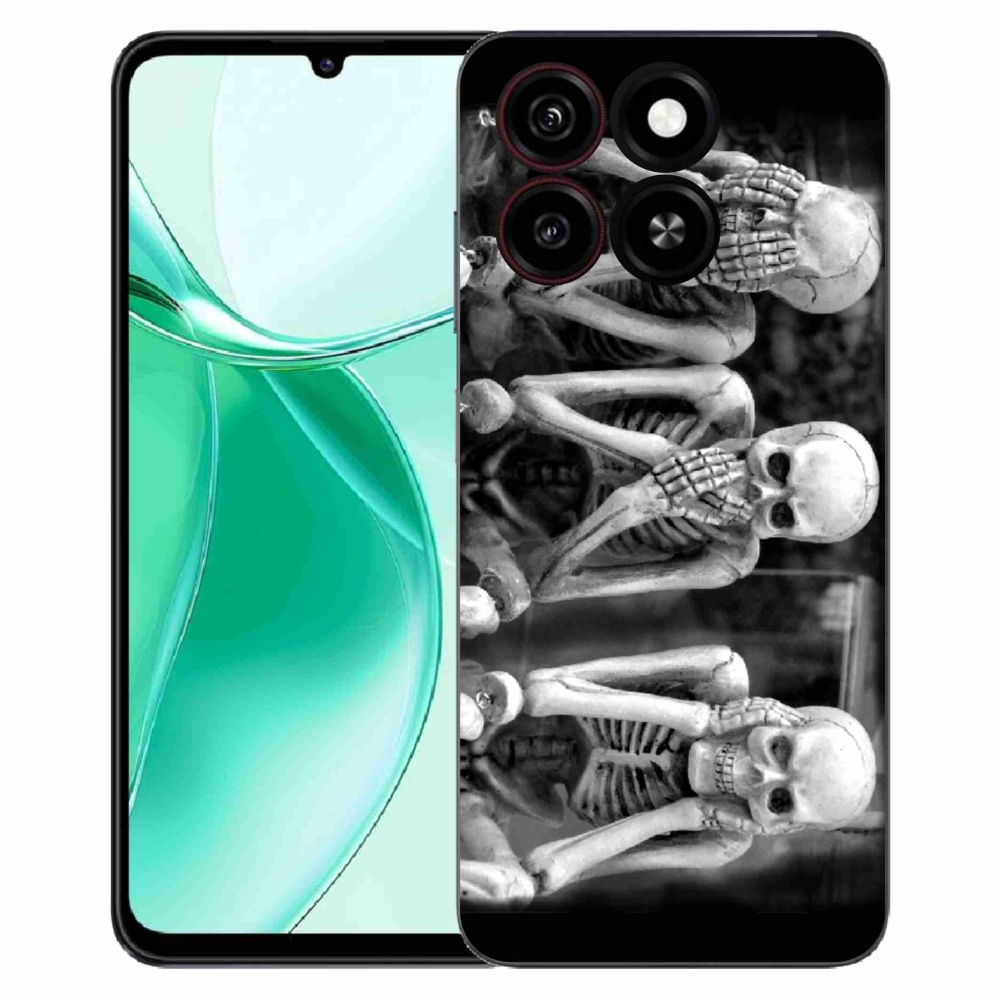 ZTE Blade A35 zselés borítás mmCase - csontvázak