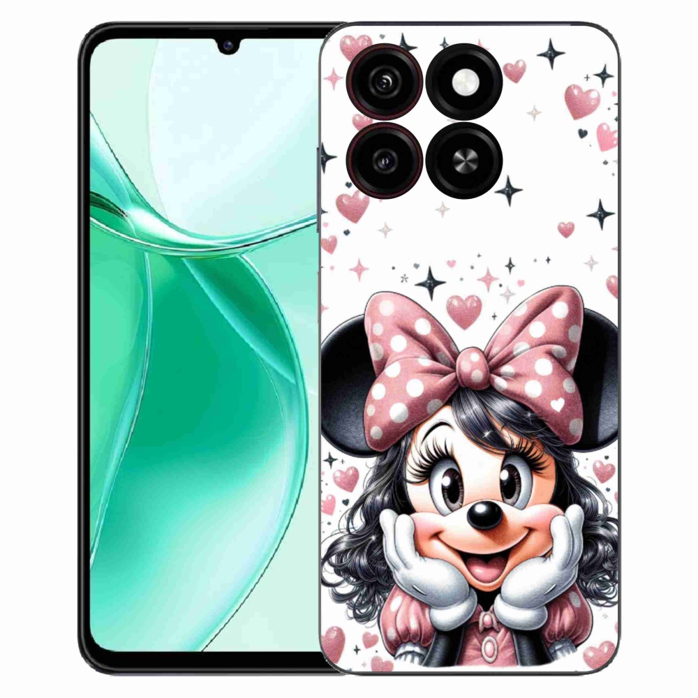 ZTE Blade A35 zselés tok mmCase - minnie