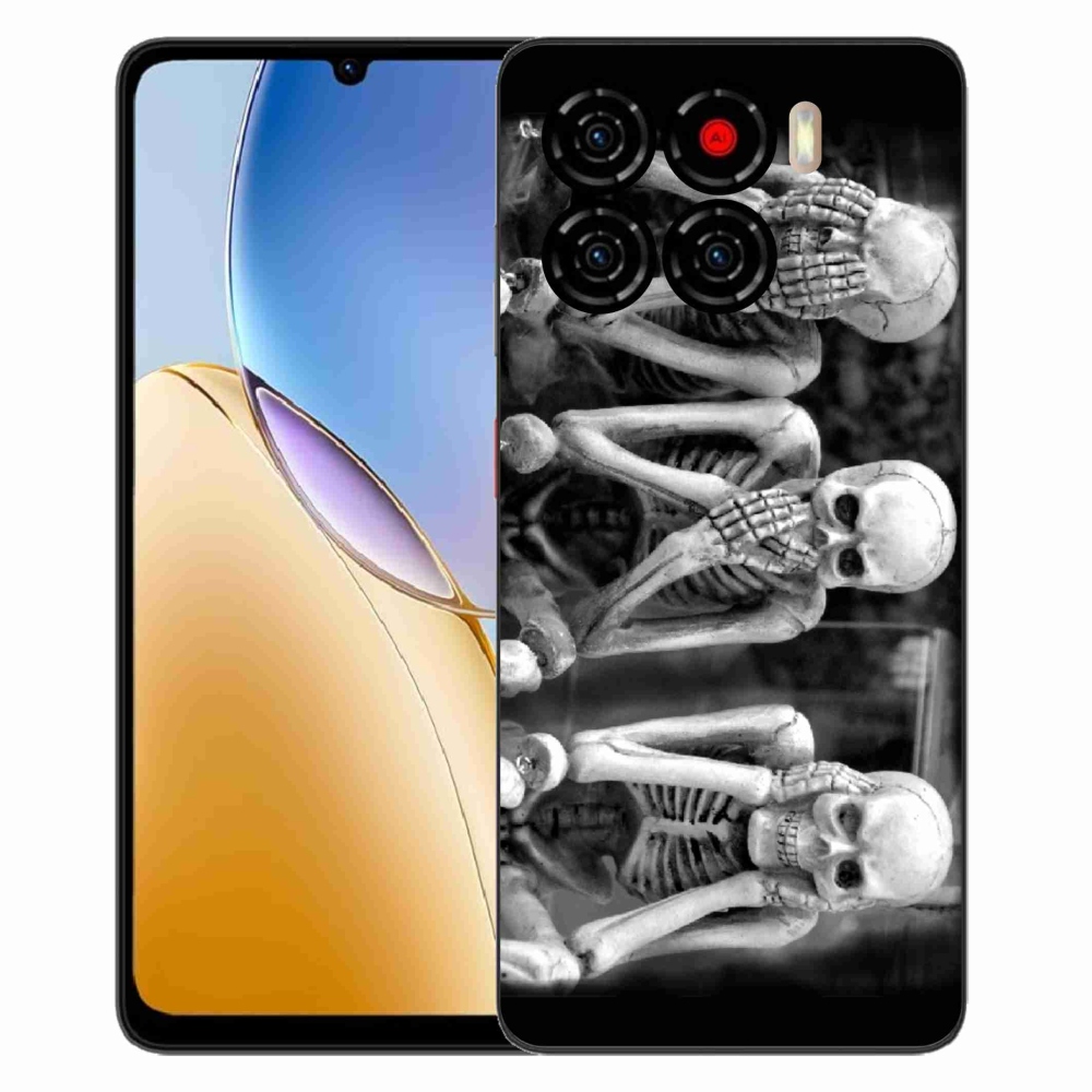 ZTE Blade A56 zselés tok mmCase - csontvázakhoz