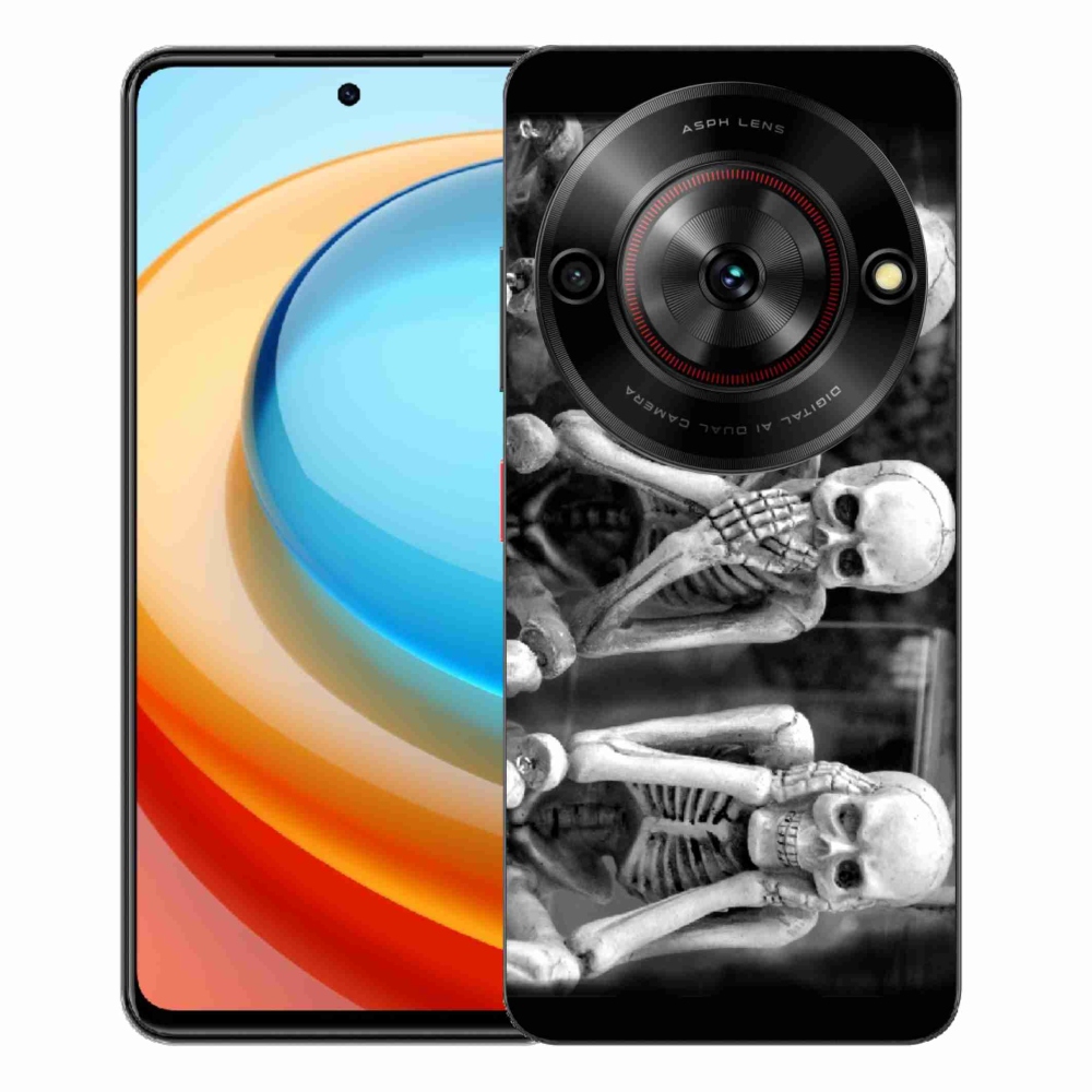 ZTE Blade A75 zselés tok mmCase - csontvázakhoz