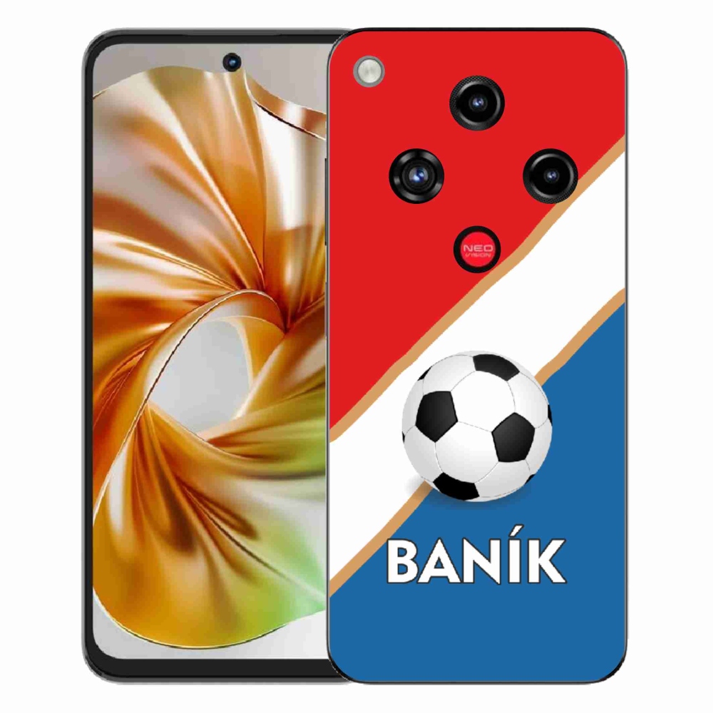 ZTE Nubia Focus 2 zselés borító mmCase - Baník