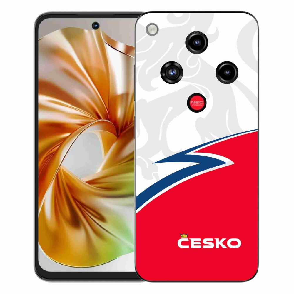 ZTE Nubia Focus 2 zselés tok mmCase - Egyesült Királyság 1
