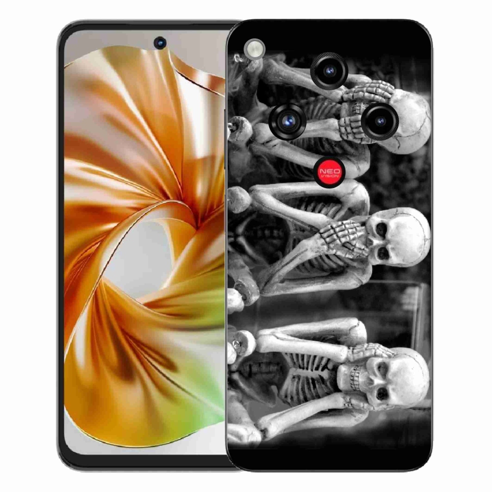 ZTE Nubia Focus 2 zselés borító mmCase - csontvázakhoz