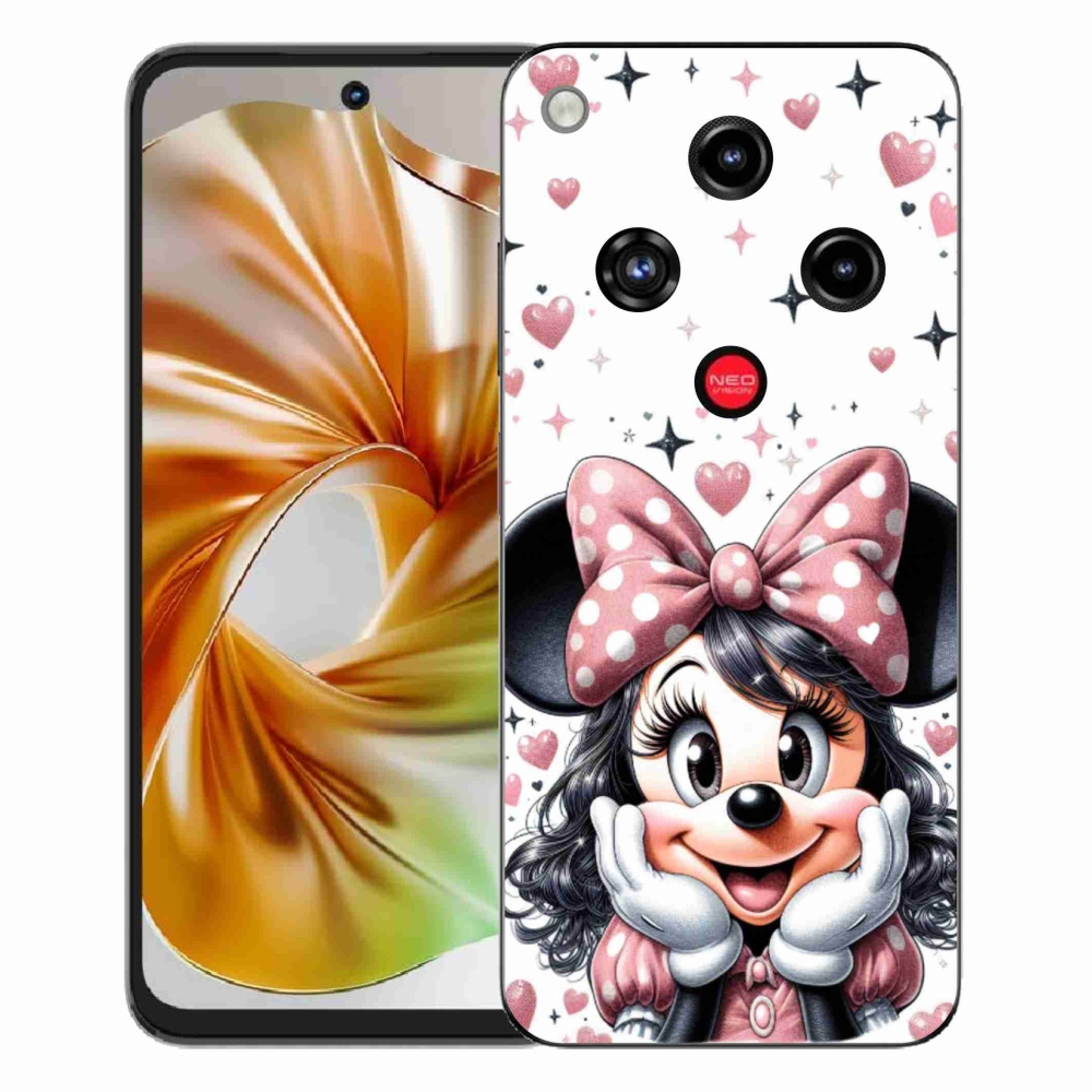 ZTE Nubia Focus 2 zselés tok mmCase - minnie