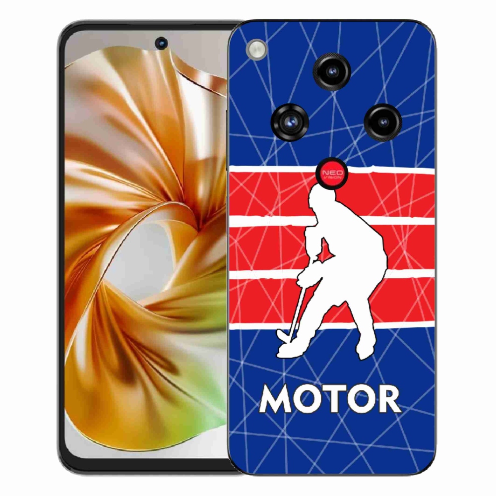 ZTE Nubia Focus 2 zselés tok mmCase - Motor
