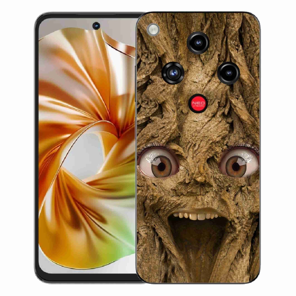 ZTE Nubia Focus 2 zselés borító mmCase - vidám fa szemekkel