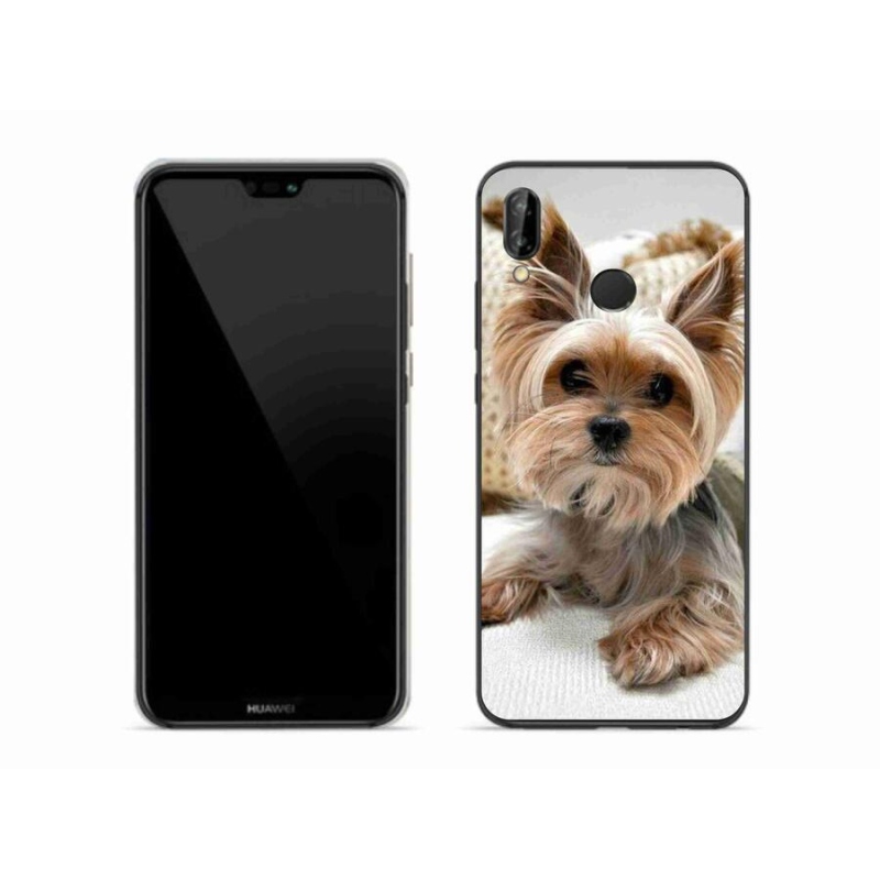 Gél tok mmCase a Huawei P20 Lite készülékhez - Yorkshire 5