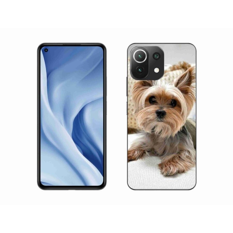 Gél tok mmCase a Xiaomi 11 Lite 5G NE számára - Yorkshire 5