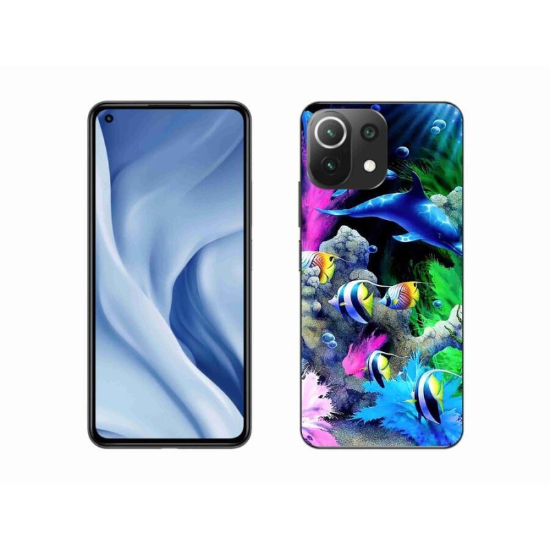 Gél tok mmCase a Xiaomi 11 Lite 5G NE számára - Sea World