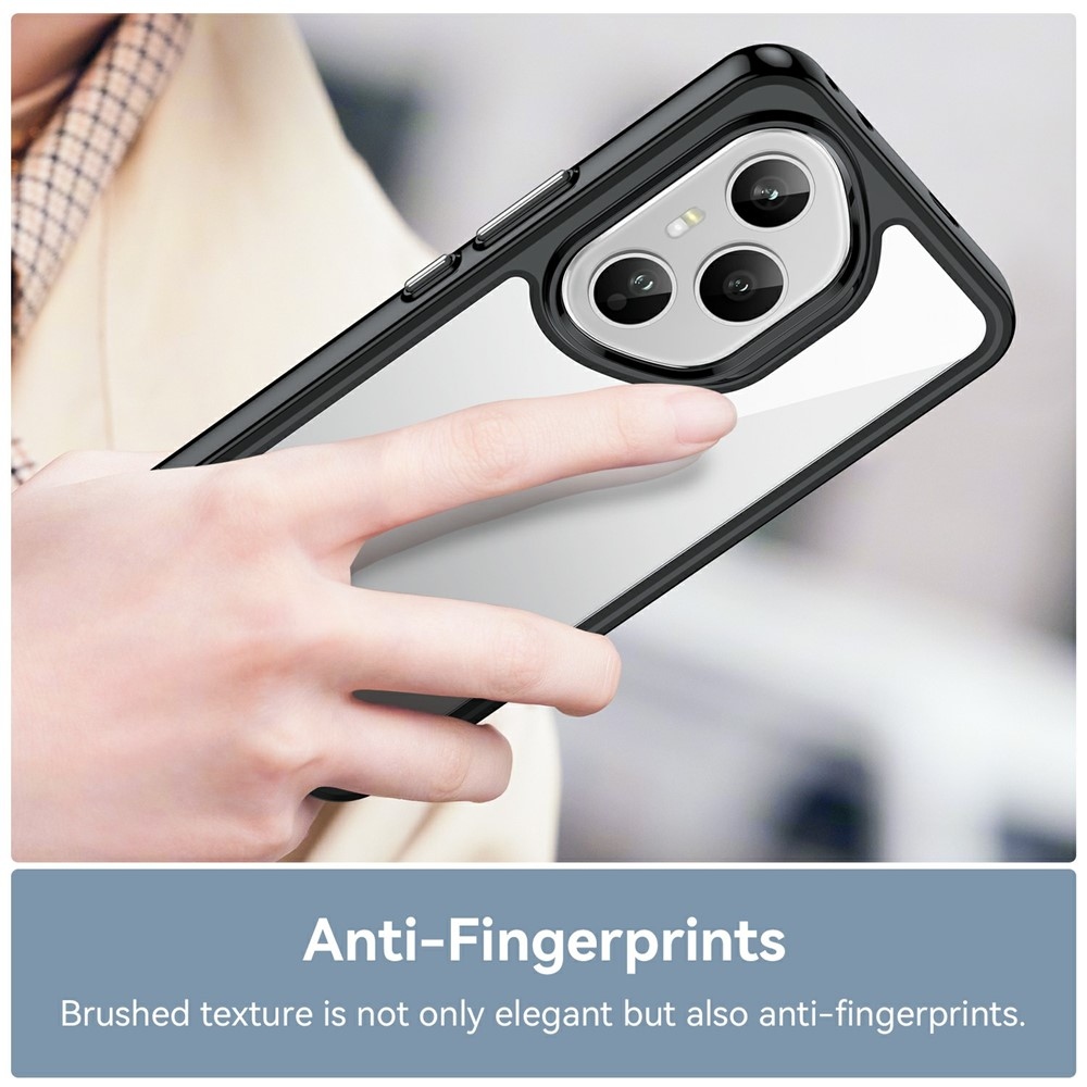 Gél tok fix hátlappal Honor 400 Pro-hoz - fekete