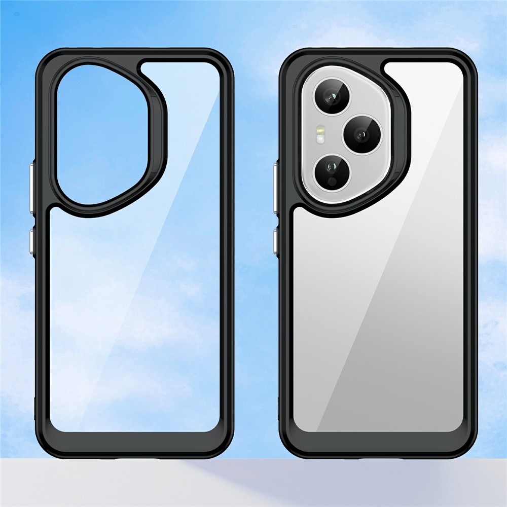 Gél tok fix hátlappal Honor 400 Pro-hoz - fekete