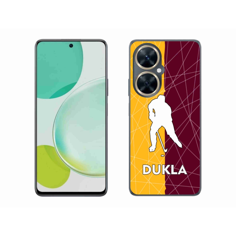 Zselés borítás mmCase a Huawei Nova 11i készülékhez - Dukla