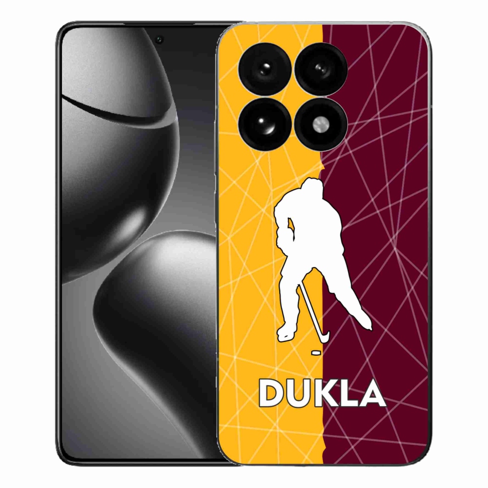 Gél borítás mmCase a Xiaomi 15T-hez - Dukla