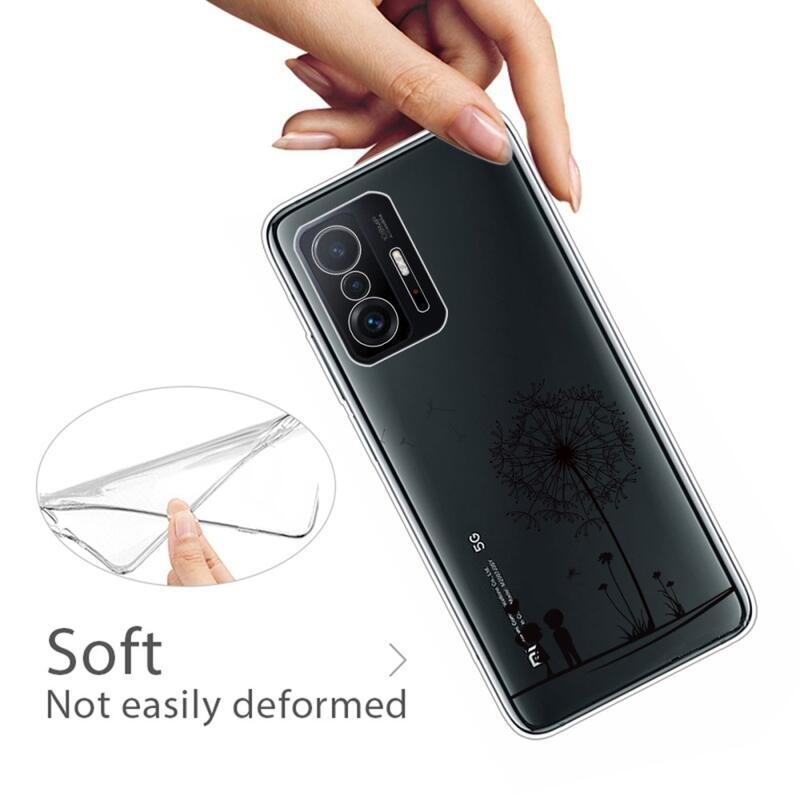IMD zselés tok Xiaomi 11T/11T Pro - pitypang