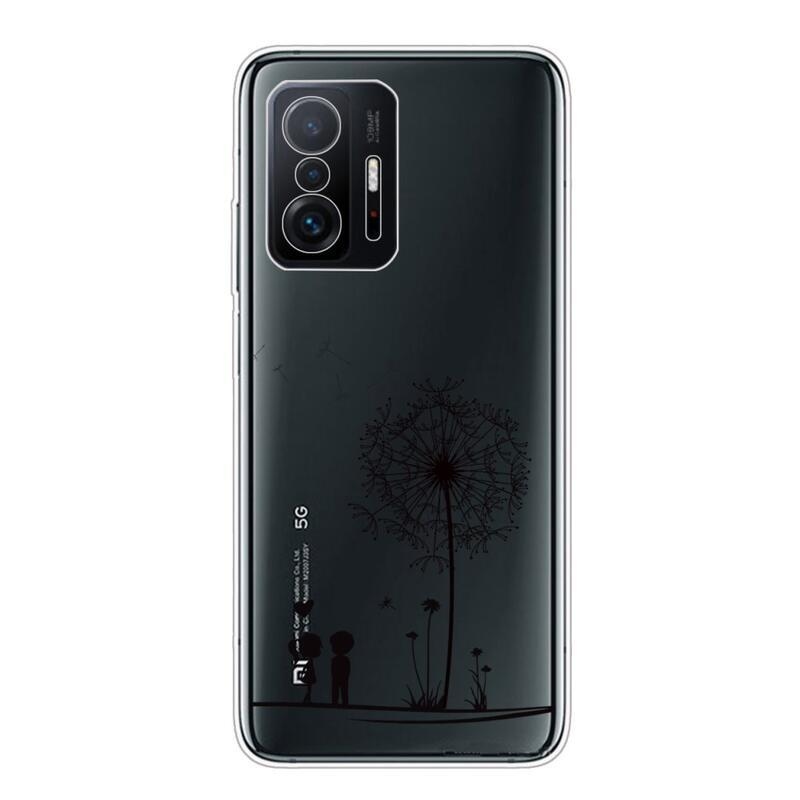 IMD zselés tok Xiaomi 11T/11T Pro - pitypang