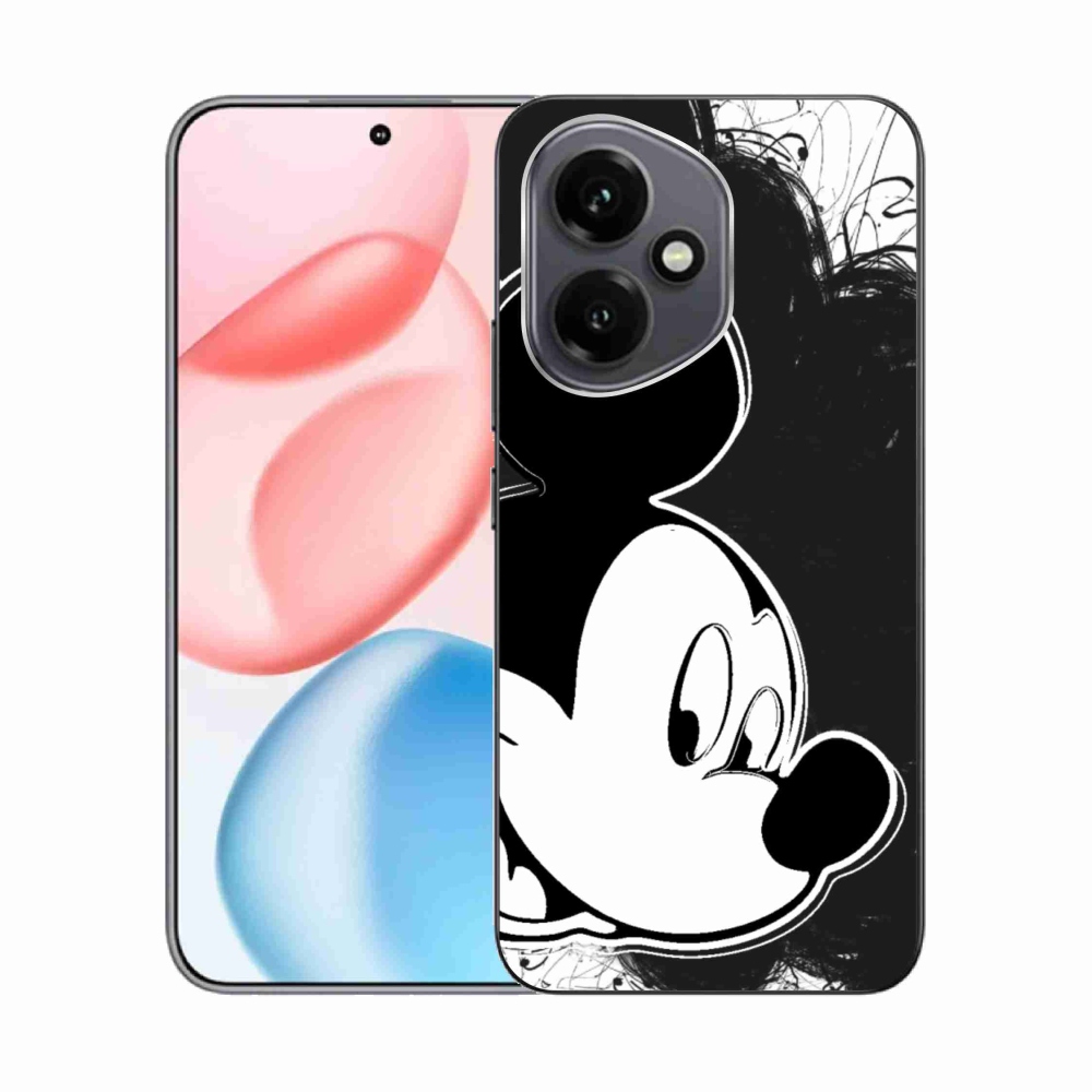 Zselés borító mmCase a Honor 400-hoz - mickey egér 1