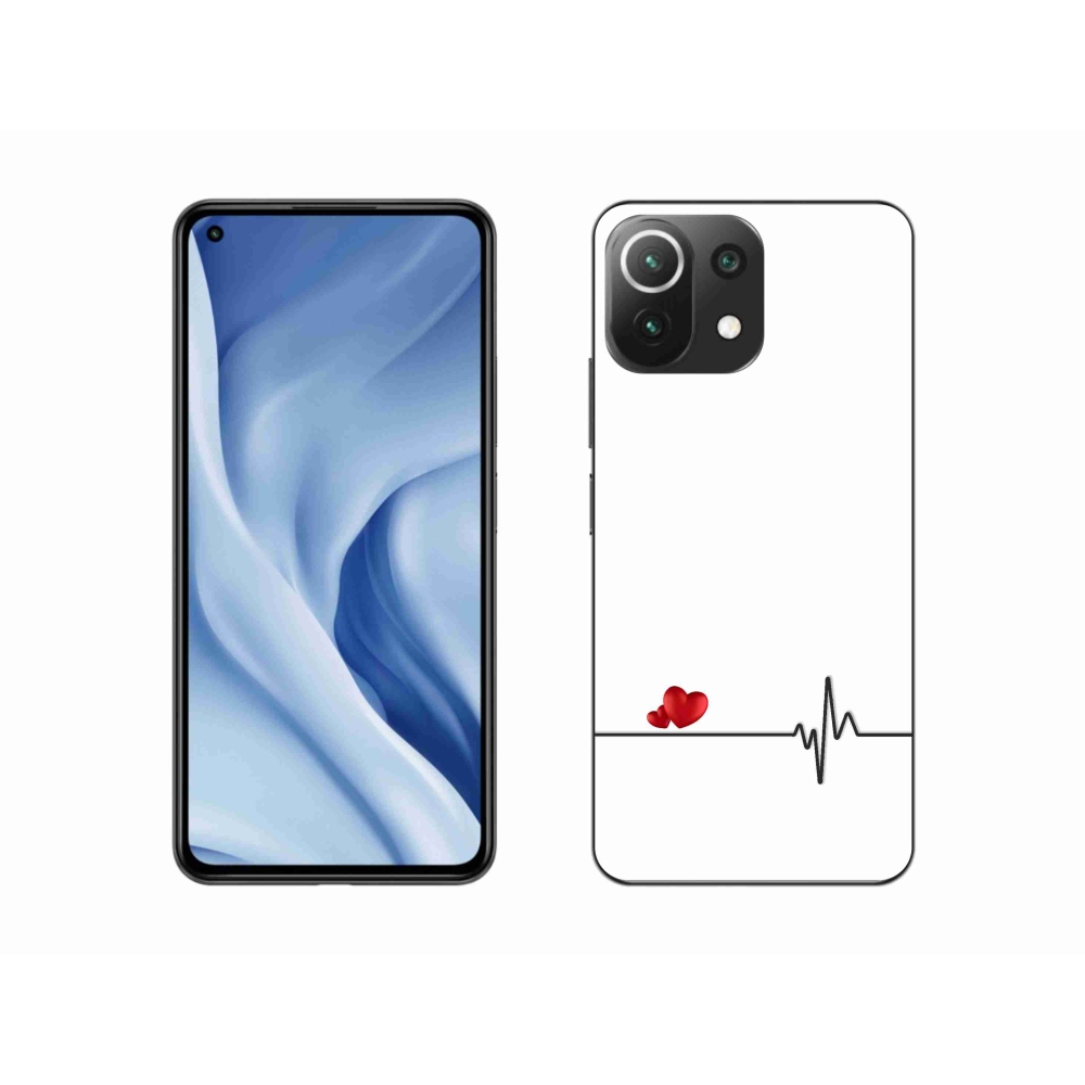 Gél borító mmCase a Xiaomi Mi 11 Lite 4G/5G-hez - szív és szívverés fehér háttérrel