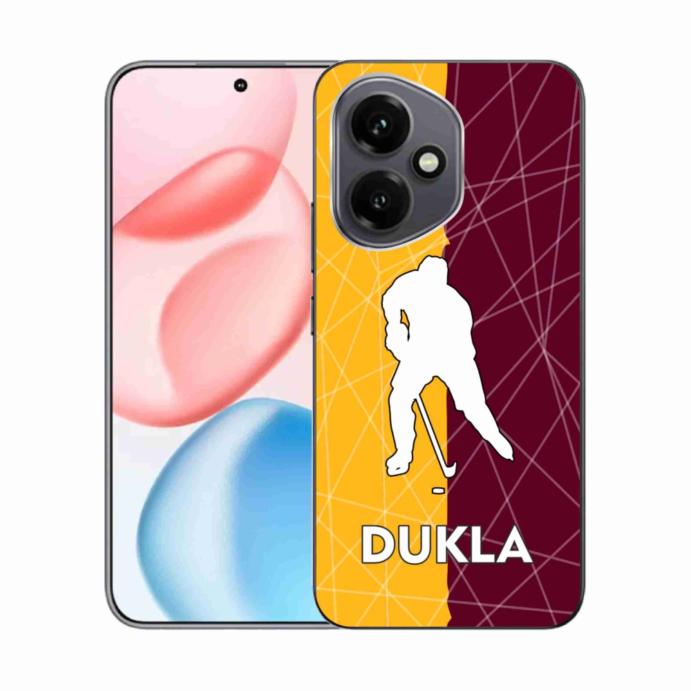 Zselés borítás mmCase a Honor 400-hoz - Dukla