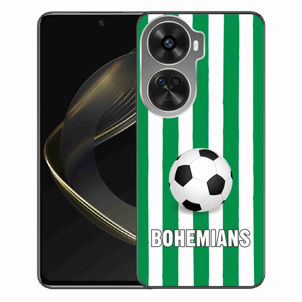 Gél borítás mmCase a Huawei Nova 12 SE-hez - Bohemians