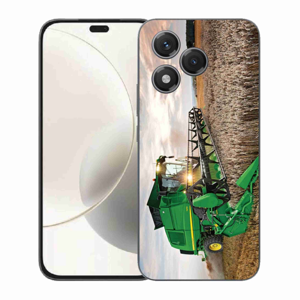 Zselés borítás mmCase a Honor 400 Lite-hoz - kombinálni