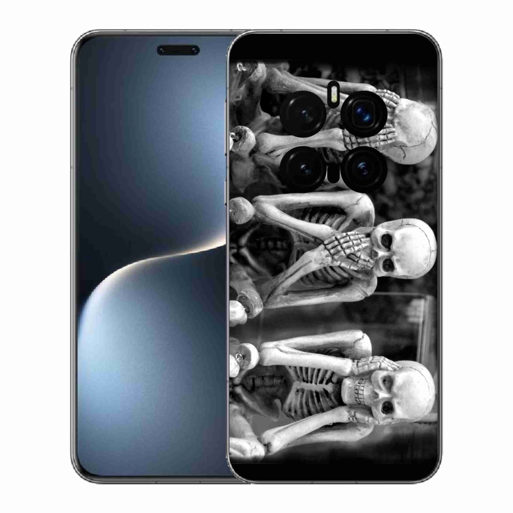 Zselés borítás mmCase a Honor Magic 7 Pro 5G számára - csontvázak
