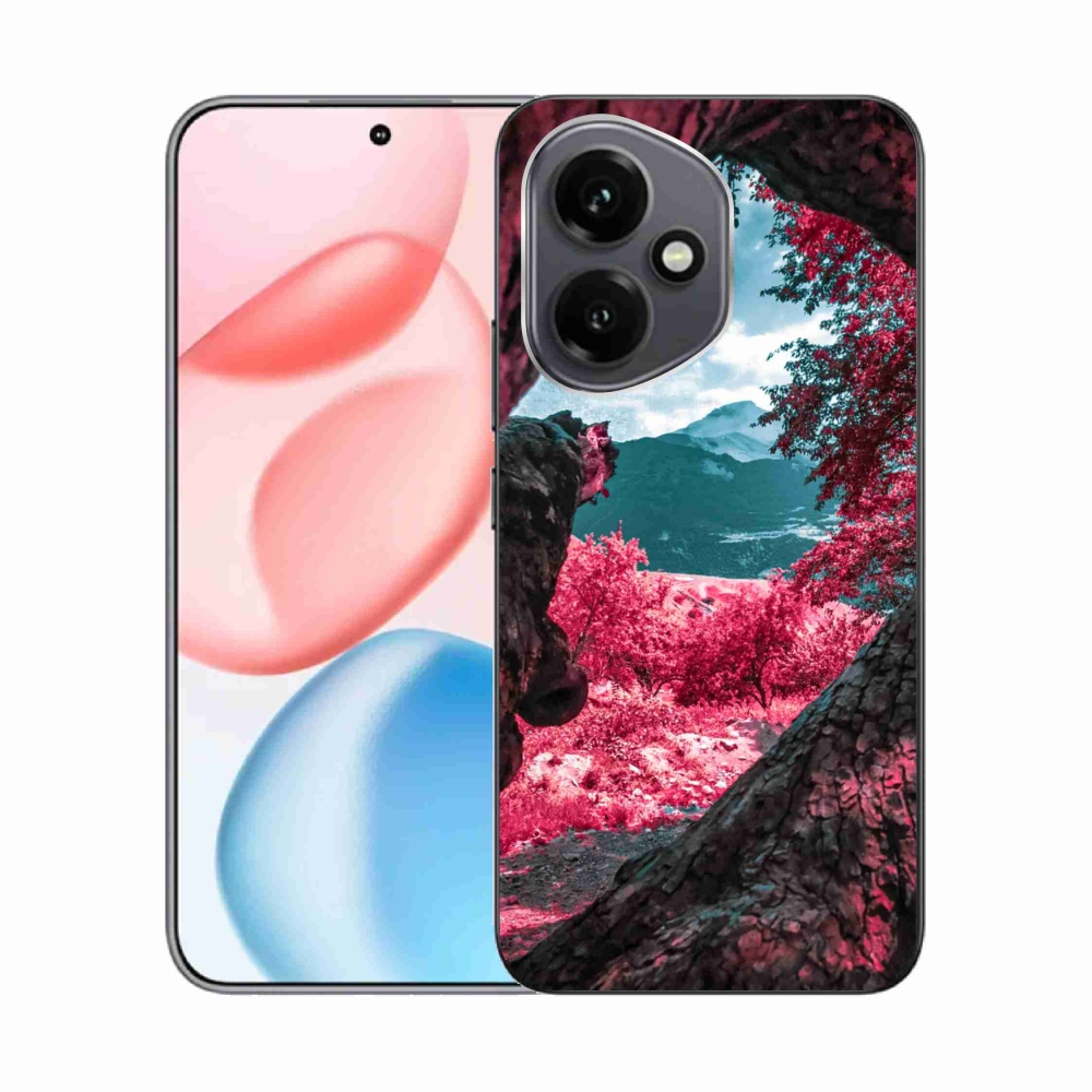 Zselés borítás mmCase a Honor 400-hoz - mountain view