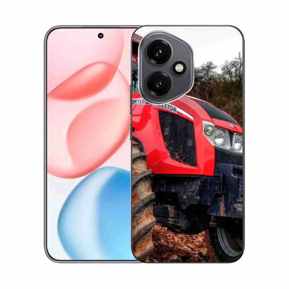 Zselés borítás mmCase a Honor 400-hoz - zetor