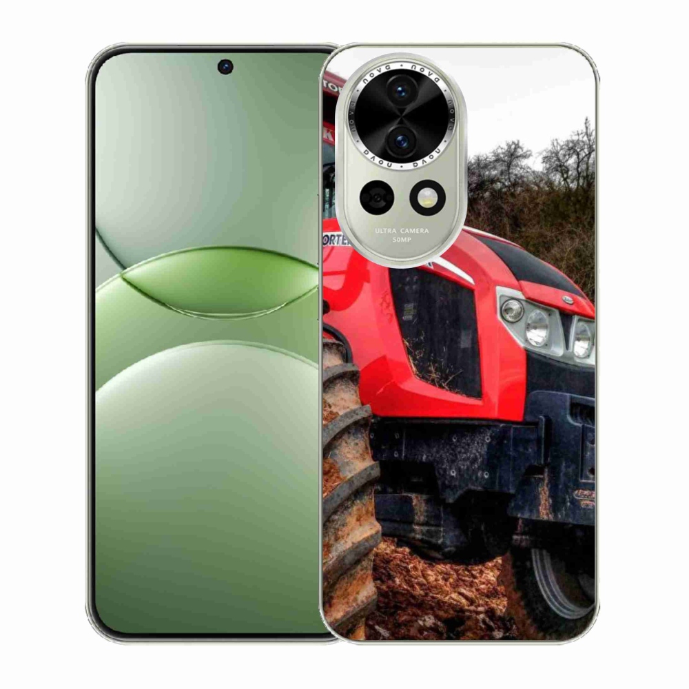 Gél borítás mmCase a Huawei Nova 13 5G készülékhez - zetor